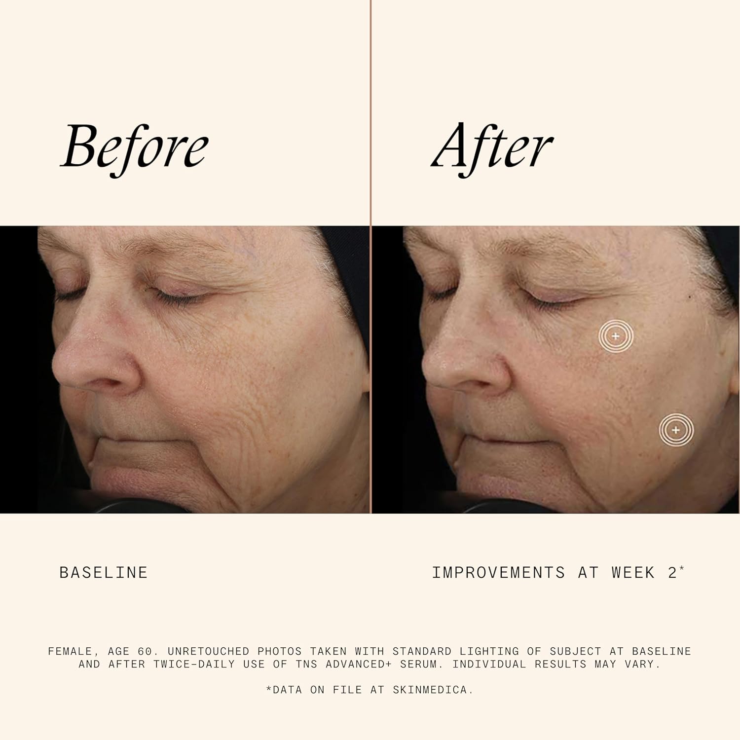 SkinMedica TNS Advanced+ Serum - Our Premium Facial Skin Care Product, the Secret to Flawless Skin. Age-Defying Face Serum for Women is Proven to Address Wrinkles and Fine Lines for Glowing Skin,1 Oz